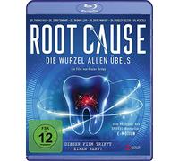 Frazer Bailey - Root Cause [Blu-Ray] [Import]