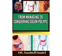 From Managing To Conquering Colon Polyps: Expert Guide To Colon Polyps Causes, Symptoms, Treatment, And Achieving Complete Wellness