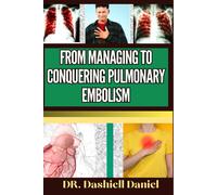 From Managing To Conquering Pulmonary Embolism: Expert Guide To Understanding The Causes, Recognizing Symptoms, Prevention And Embracing Effective Treatments For A Vibrant And Healthy Life