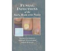 Fungal Infections Of The Skin And Nails