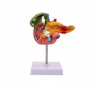 FytStycale Pancréas Maquette Anatomique Modèle Digestif Organe Pathologique avec Duodénum et Vésicule Biliaire en PVC Peint à la Main Adapté à l'Enseignement