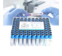 GCLCPAEN Tube De Prélèvement Sanguin sous Vide en Plastique,Citrate De Sodium 1:9,Prélèvement Sanguin sous Pression Négative,2Ml/5Ml/10Ml,Bouchon Bleu,pour Tests en Laboratoire,100 Pièces,5ML