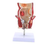 Gcljlmy Modèle rectal pathologique humain, outils pédagogiques, démonstrations pratiques de formation professionnelle, outil d'entraînement pour l'apprentissage en étude