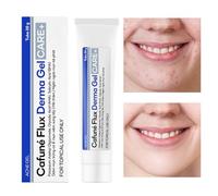 Gel Traitant Pour Les Boutons Du Visage, Solution Non Grasse Et Légère Pour L'Élimination, Gel Visage Anti-Boutons, Pour Femmes Filles Famille Amis Collègues Usage Quotidien Voyage Et Nuit