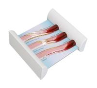 Generic Modèle de Vaisseau Sanguin de Lipoprotéine, 3 Modes Faciles à Comprendre Modèle de Vaisseau Sanguin de Lipoprotéine LDL HANCHES PP Pratiques pour Outil éducatif
