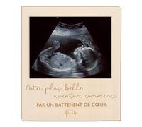 Générique Cadre Photo Magnétique Cadeau (Annonce grossesse)