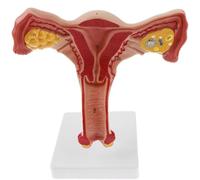 Générique Modèle anatomique de l'utérus et de l'ovaire féminins, organe génital féminin humain pour l'étude ou l'enseignement de l'enseignement des sciences médicales