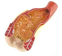 Générique Modèle anatomique de structure du rectum humain, du canal anal et de l'anus, modèle d'organe du rectum anatomique médical, chirurgie anorectale, étude de chirurgie générale, enseignement