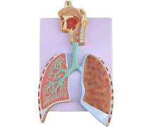 Générique Modèle anatomique du système respiratoire humain montrant les alvéoles, l'arbre bronchique droit, les voies respiratoires et les poumons pour l'étude et l'éducation