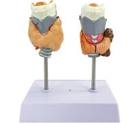 Générique Modèle d'anatomie de la thyroïde, modèle d'anatomie pathologique de la thyroïde humaine, modèle d'anatomie normale et pathologique de la thyroïde pour l'enseignement en classe.
