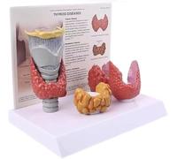 Générique Modèle d'anatomie de la thyroïde, modèle humain de maladie thyroïdienne avec carte d'instruction, à l'échelle 3:1 montrant le système digestif pathologique de la thyroïde