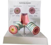 Générique Modèle d'anatomie de l'asthme humain, modèle bronchique du système respiratoire, modèle de cas trachéal humain pour les étudiants, modèle d'enseignement de l'affichage de l'étude