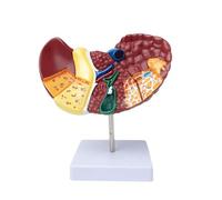 Générique Modèle d'anatomie du Foie Humain, modèle d'anatomie du Foie Grandeur Nature, modèle de cirrhose du Foie pour l'étude et la Recherche à l'école