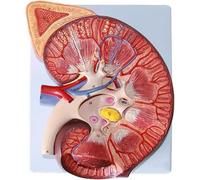 Générique Modèle d'anatomie du rein humain agrandi 3X - comprend l'anatomie de la glande surrénale et des néphrons pour l'aide à la formation médicale