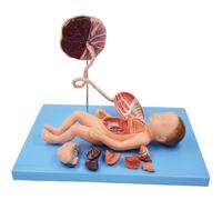 Générique Modèle d'anatomie fœtale, modèle d'anatomie des viscères néonatals, mannequin de bébé avec cordon ombilical et placenta, 13 parties détachables, pour écoles, hôpitaux, cabinet médical