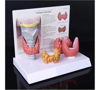 Générique Modèle d'anatomie thyroïdienne, outil d'enseignement du modèle anatomique du corps humain. Modèle de nodule thyroïdien, 3:1 montrant le système digestif pathologique de la thyroïde.