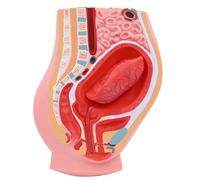 Générique Modèle de détachement du placenta du fœtus, modèle de mannequin d'enseignement de l'anatomie pelvienne de l'utérus féminin, modèle de section sagittale de la cavité abdominale
