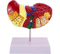 Générique Modèle de foie humain - Modèle de pathologie anatomique du foie, avec une texture de base et claire et des caractéristiques pathologiques Modèle de cirrhose du foie pour l'étude