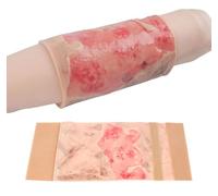 Générique Modèle d'entraînement aux brûlures pour les membres, module de formation aux brûlures des membres de 2-3 degrés, portable et réutilisable, apprendre à soigner les brûlures