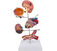 Générique Modèle d'hypertension humaine - Modèles miniatures d'anatomie du cerveau, des yeux, du cœur, des reins et des artères, Aides pédagogiques scientifiques médicales