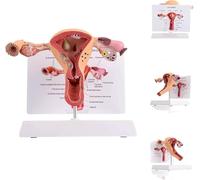 Générique Modèle d'utérus en 3D Modèle d'utérus Modèle d'ovaire Anatomie humaine Anatomie de l'appareil reproducteur féminin Réplique Anatomie pour les médecins Outil pédagogique