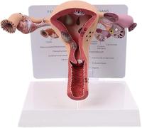 Générique Modèle d'utérus féminin, modèle de pathologie de l'utérus féminin humain, maladie de l'ovaire Dissection Biologie Aide à l'enseignement Anatomie Lésion Utérus