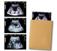 Generisch Fausse image échographique de grossesse - Photos échographiques personnalisées avec semaine, date et nom d'hôpital, cadeau amusant pour couples, partenaires, mari ou femme