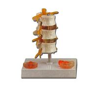 GiMa 40180 modèle maladie hernie, Lot de 1 pièce