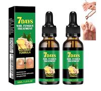 Ginger Nail Treatment, Ginger Cuticle Care Oil for Nails | Nail Treatment, Ginger Nail, Nail Nail Care,Nail Growth Serum,Ginger Nail Serum, Nail Nutrient Oil Strengthener Oil (2)