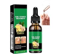 Ginger Traitement des ongles Support pour ongles, Ginger Nail Growth Serum, sérum de croissance des ongles au gingembre, traitement des ongles, huile de soin des cuticules au gingembre (1pcs)