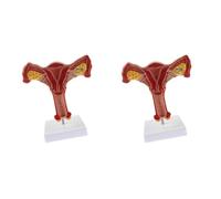 Giwnhvx 2X 1:1 Humain UtéRus Ovaire Trompes de Fallope Modèle Anatomique Anatomie Humaine Modèle Outils PéDagogiques