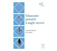 Glaucome primitif à angle ouvert: Rapport SFO 2014