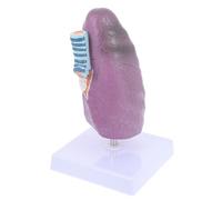 GLEAVI Modèle Pulmonaire Pathologique Réaliste Modèle Éducatif Du Poumon de Fumeur pour Enseignement Médical Outil pour Écoles de Physiologie et Anatomie