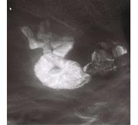 Alice Phoebe Lou – Glow – Vinyle – Edel