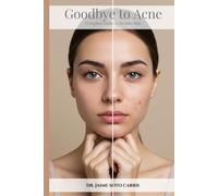 Goobye Acne: A Guide to Healthy Skin: How to Finally Get Rid of Acne When Nothing Else Has Worked. For patients, healthcare and parents