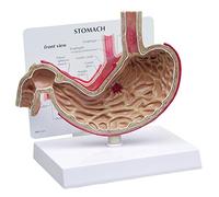 GPI Anatomicals 2000 Modèle d’estomac avec ulcères