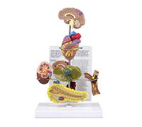 GPI Anatomicals 4020 Modèle de syndrome métabolique