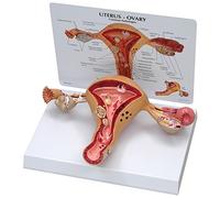 GPI Anatomicals W33352 Modèle d’utérus et d’ovaires