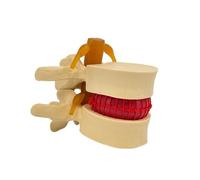 Gralara Modèle Colonne Vertébrale | Modèle protrusion discale Discale Lombaire, Monté sur Support, pr Eeignement Orthopédique, Éducation Sportive, Jaune Os