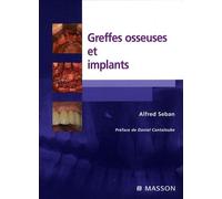 Greffes osseuses et implants Alfred Seban (Auteur)