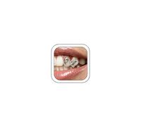 Grilles dorées pour vos dents Grillz pour femmes - Grilles de bouche en forme de cœur creux - Grillz pour vos dents - Accessoire personnalisé Hip Hop, Small, Cuivre, Pas de pierre précieuse