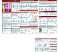 Guide de poche ECG, interprétation du rythme ECG, carte de référence compacte double face, guide d'infirmière de poche à interprétation rapide, cartes mémoires paramédicales, livre d'interprétation
