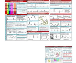 Guide de poche ECG, interprétation du rythme ECG, carte de référence compacte double face, guide d'infirmière de poche à interprétation rapide, cartes mémoires paramédicales, livre d'interprétation