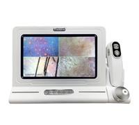 guoyjmm Analyseur de Cheveux de Peau, Détecteur de Cuir Chevelu 50X 200X, Analyseur de Santé de la Peau 11 Pouces Détecteur de Follicule Pileux Microscope Instrument de Soins de la Peau