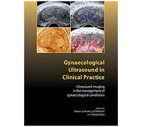 Gynaecological Ultrasound In Clinical Practice