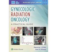 Gynecologic Radiation Oncology: A Practical Guide