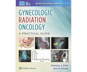 Gynecologic Radiation Oncology: A Practical Guide