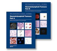 Haematolymphoid Tumours: Who Classification of Tumours