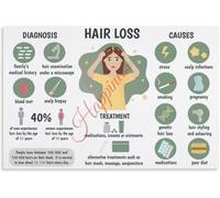 Hair Fall Information Chart Poster Scalp Knowledge
