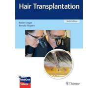 Hair Transplantation